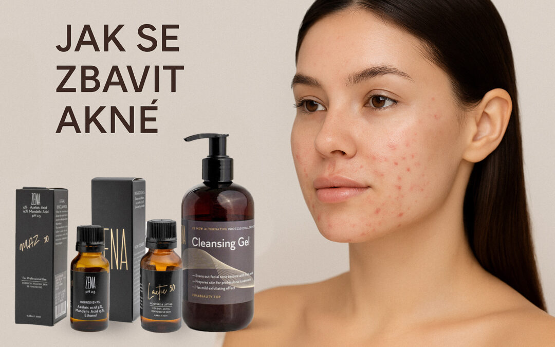Proč vzniká akné?